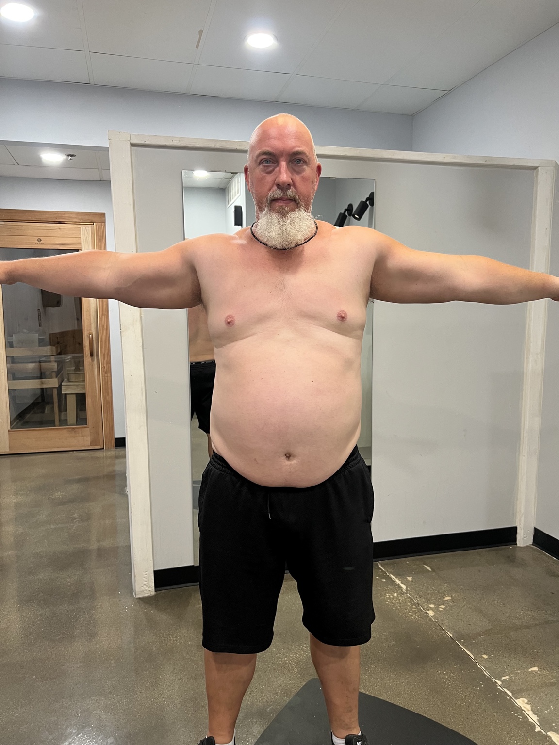 Mitch’s transformation — Front view before transformation